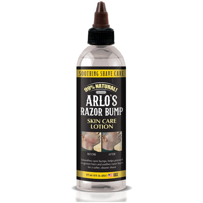 ARLO'S RAZOR BUMP LOTON 6oz